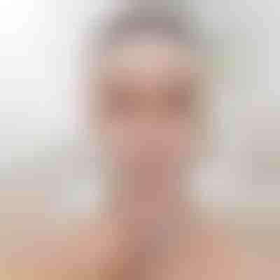 Ζώνη ανόρθωσης και διαμόρφωσης προσώπου | KIMLIFT